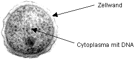 electron micrograph of H. influezae