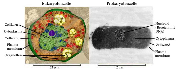 Unterschiede zwischen eukaryontischen und prokaryontischen Zellen
