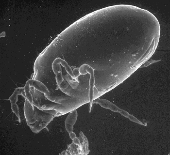 mite scanning electron micrograph